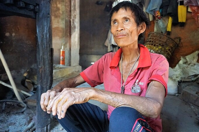 Căn bệnh khiến Lang mất sức lao động, không còn vào rừng, anh chỉ ở nhà, thi thoảng ra quán mua thức ăn. Những tháng ngày cuối đời, trên tay ông Lang là những đường gân xanh nổi khắp, khuôn mặt hốc hác, nước da sạm đen đổi sang màu vàng yếu ớt thấy rõ.