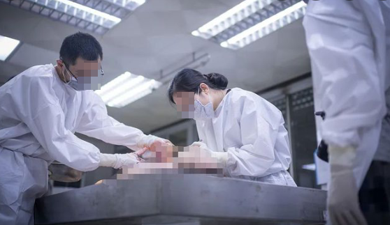 Cùng thời điểm này, qua các biện pháp vận động, thuyết phục, gia đình cháu T. đã đồng ý để cơ quan công an tiến hành khám nghiệm pháp y. Đúng như dự đoán, vết thương của cháu T là do vật sắc nhọn, bản rộng và có lực lớn. Cơ quan điều tra cũng thu giữ tại bếp nhà Đoàn một con dao, khi giám định đã phát hiện ra mẫu máu còn bám dính trên đó là máu của cháu T. Con dao này cũng hoàn toàn trùng khớp với vết thương trên vùng đầu, mặt nạn nhân. (Ảnh minh họa, nguồn ảnh Internet)