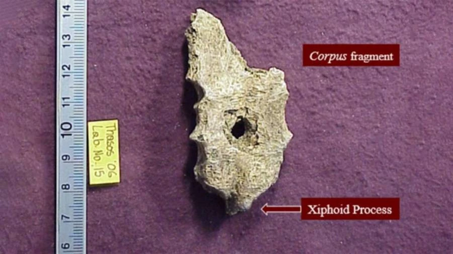 Lỗ tròn hoàn hảo trên hài cốt cổ đại, chuyên gia vén màn bí ẩn lớn