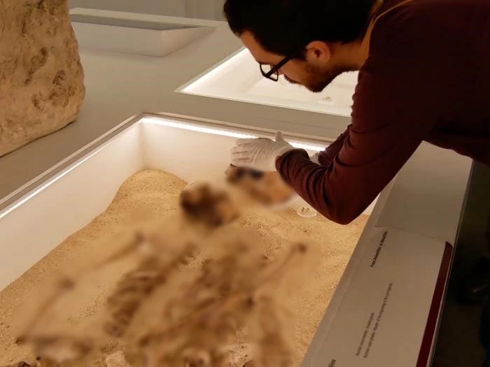 'Nội soi' hài cốt 12.000 tuổi, phát hiện thiếu nữ mắc bệnh hiếm gặp