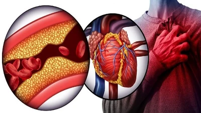 Những bệnh mạn tính có thể gây tử vong 