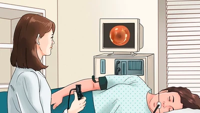 Nội soi tiêu hóa: Lựa chọn nội soi thường hay gây mê?