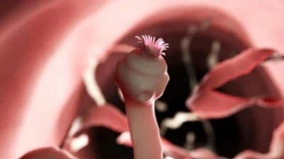 Thói quen ăn uống “mở đường” cho sán vào người, ít ai để ý