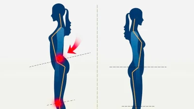 Chọn giày dép đúng cách tránh bệnh cột sống