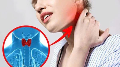 Bệnh tuyến giáp ngày càng tăng, phòng ngừa thế nào?