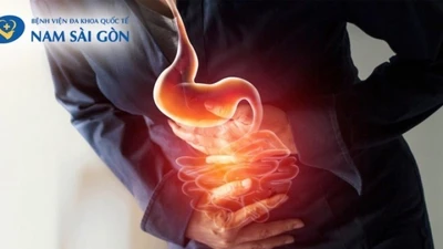 Cảnh báo viêm loét dạ dày – tá tràng: Nhận biết sớm để điều trị kịp thời, tránh biến chứng