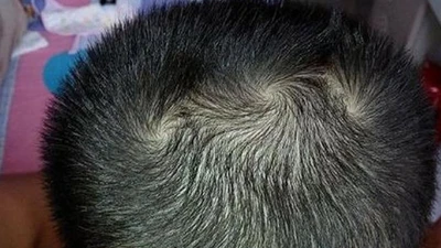 Ai có vòng xoáy quý tướng trên người sung sướng cả đời