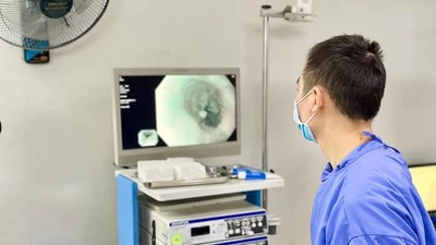 Nội soi tầm soát phát hiện sớm ung thư đường tiêu hóa