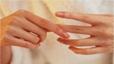 Bệnh viêm khớp ở phụ nữ và cách điều trị