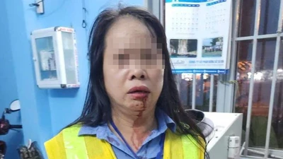 Vấn đề pháp lý vụ nhân viên gác tàu bị đánh gãy xương mũi