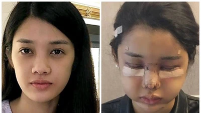 Trình Mỹ Duyên “đập đi làm lại” gương mặt, nhan sắc giờ thế nào?