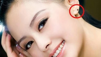 Phụ nữ sở hữu nốt ruồi này, coi chừng... giàu mất gỡ