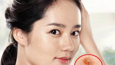 4 vị trí mọc lông dự báo số đại gia, chớ dại nhổ đi