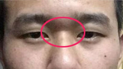 Người có bốn tướng mạo này cả đời sẽ nghèo khó