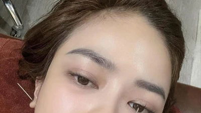 Ca sĩ Dương Hoàng Yến nhập viện cấp cứu vì liệt dây thần kinh số 7