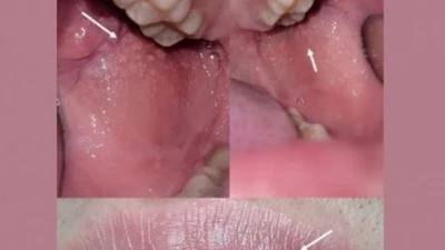 Cặp đôi lo sợ mắc bệnh tình dục sau quan hệ bằng miệng, bác sĩ chỉ ra sự thật