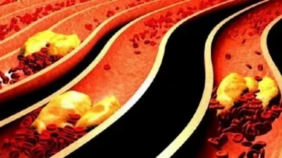 4 thói quen xấu dễ làm tắc nghẽn mạch máu, đặc biệt là điều cuối cùng
