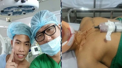"Thảm họa mạng" Tùng Sơn dao kéo để trông bớt xấu?