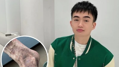 Căn bệnh Tina Thảo Thi mắc phải khiến chân như bị ghẻ nguy hiểm thế nào? Liệu có chữa khỏi hoàn toàn được không?