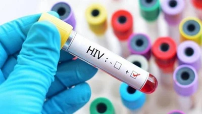 Những yếu tố nào khiến việc điều trị HIV thất bại?