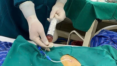 Cứu sống cụ ông 71 tuổi bị tràn dịch màng ngoài tim do lao
