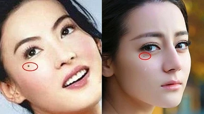 10 nốt ruồi lận đận: Ai có một đời xui xẻo, dễ tai ương