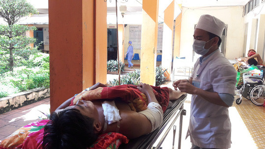 Đây không phải lần đầu có những tai nạn thương tâm do người dân cưa vật liệu nổ. Ngày 6/8/2016, Bệnh viện Đa khoa tỉnh Đắk Lắk đã tiếp nhận 2 nạn nhân bị thương do cưa bom gồm: Lê Thúc Hải (28 tuổi) và Lê Minh Dũng (29 tuổi), cùng ngụ xã Liên Sơn, huyện Lắk. Ảnh: NLĐ.