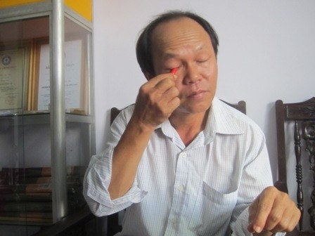 Ăn hết 1 quả ớt đã là khó với nhiều người nhưng với dị nhân Bùi Ngọc Vinh (ngụ tại TP Huế) thì cả kg ớt cũng không làm khó anh. Phát hiện ra khả năng ăn nhiều ớt mà không hề hấn gì từ khi còn nhỏ, anh Vinh trở nên nổi tiếng nhờ tài ăn cả kg ớt, tắm trong ớt mà không hề hấn. Tại Festival Huế 2006, với màn diễn giã nhỏ những trái ớt tươi rồi chà khắp cơ thể và mắt, anh Vinh đã làm nhiều người trố mắt, sửng sốt. Năm 2007, tại Đà Nẵng, anh Bùi Ngọc Vinh biểu diễn thành công màn tắm trong nước ớt. Ảnh: ĐSPL.