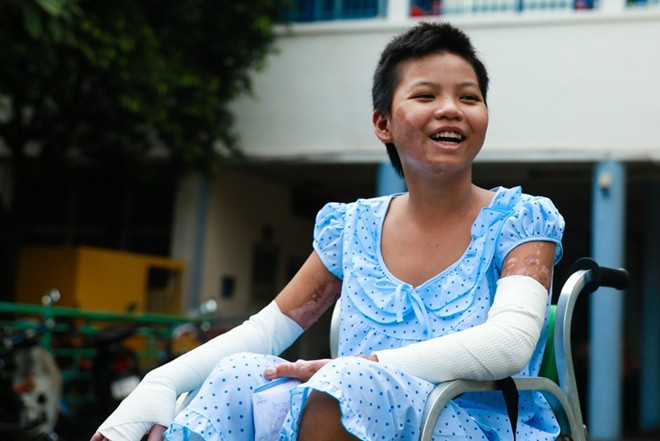 Dù đi lại vẫn còn đau do các lớp da căng lên và phải ngồi xe lăn nhưng bé gái bán vé số luôn nở nụ cười tươi.
