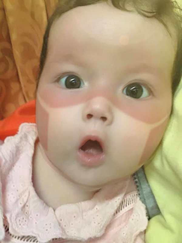 Em bé vẫn chưa hiểu chuyện gì đang xảy ra. (Ảnh: Nhật Hạ)