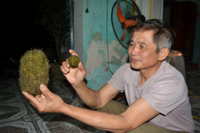 Tại Hải Dương, gia đình ông Nguyễn Quang Vị (Thanh Hà) phát hiện trong dạ dày và túi mật có 2 vật thể lạ màu xanh nghi là "cát lợn". Ảnh: Gia đình & xã hội.