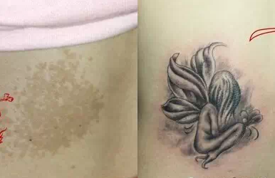 Trên cơ thể sẽ không thiếu những vết sẹo, chúng có thể đến do bẩm sinh hoặc do những tai nạn trong cuộc sống thường ngày. Nhiều người đã tỏ ra vô cùng lo lắng với những vết sẹo xấu xí, thế nhưng các bạn sẽ không phải lo khi đã có những hình xăm che sẹo hết sức nghệ thuật.
