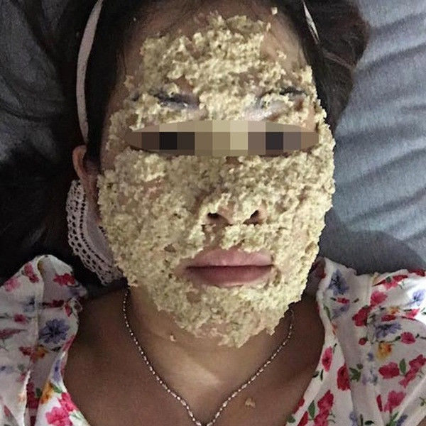 Thông thường những spa hay thẩm mỹ viện có uy tín chỉ dành cho người nhiều tiền trong khi không phải ai cũng có đủ khả năng để đáp ứng điều đó. Vì vậy, một số chị em đã tự làm tại nhà bằng những nguyên liệu thiên nhiên.