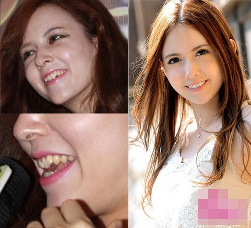 Khuôn mặt trong sáng, thánh thiện đã trở nên già nua, nhợt nhạt và thiếu sức sống hơn. Đặc biệt là nhiều lần cô để lộ hàm răng vàng ố rất mất thẩm mỹ.