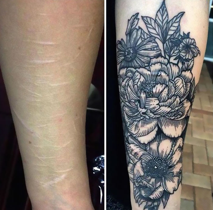 Trước vào sau khi xăm che sẹo.