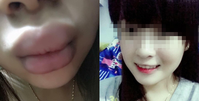Với các nữ giới nói chung và các cô gái Việt nói riêng, đồ trang điểm mà đặc biệt là cây son trở nên vô cùng quan trọng với họ. Nó đem lại sự tự tin vào một đôi quyến rũ và gợi cảm. Thế nhưng, chỉ vì thiếu hiểu biết hoặc có phần tham rẻ nên nhiều người đã mua phải những loại son kém chất lượng và phải trả giá bằng cái kết cay đắng.