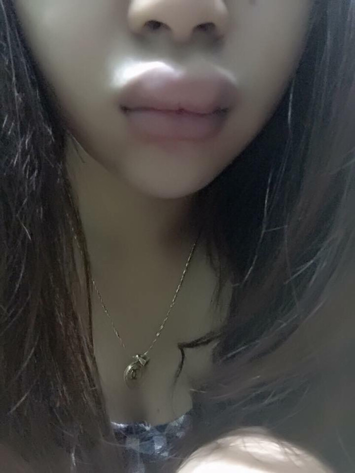 Đây không phải là lần đầu tiên mà các bạn nữ tại Việt Nam gặp phải các vấn đề với những dòng mỹ phẩm trôi nổi trên thị trường và đặc biệt là những nhãn hàng mỹ phẩm handmade. Đã có không ít những trường hợp phải trả giá đắt cho việc tin tưởng và sử dụng những loại mỹ phẩm không rõ nguồn gốc, kém chất lượng như vậy.