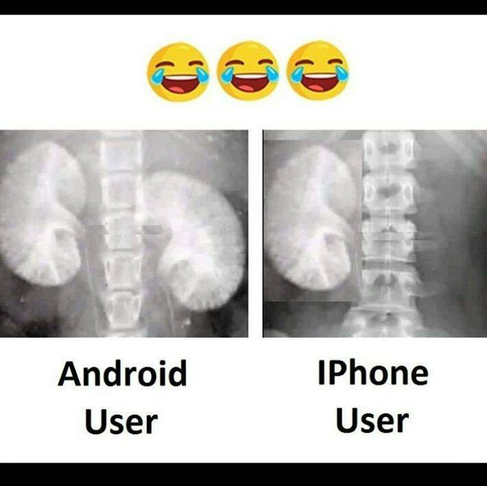 Bức ảnh hài hước cho thấy người dùng iPhone chỉ còn một quả thận, trong khi đó, các dòng Android rẻ hơn nên người mua chúng vẫn còn "đôi quả".