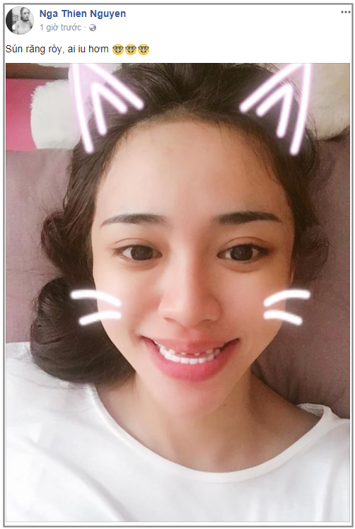 Hot girl Thiên Nga hay Thiên Nga The Face là một trong những cái tên được nhiều người biết đến sau một cuộc thi tìm đại diện thương hiệu. Cô nàng còn nổi tiếng với màn "khẩu chiến" trên mạng xã hội với Thúy Vi khi "hot girl thị phi" này chê răng Thiên Nga xấu. Không chỉ vậy, mới đây, trên trang cá nhân, Thiên Nga đã đăng tải hình ảnh hàm răng với những chiếc răng nhỏ xíu, mài nhọn hoắt và nụ cười như bị sún khiến dân mạng xôn xao. Ảnh: FBNV/Instagram.