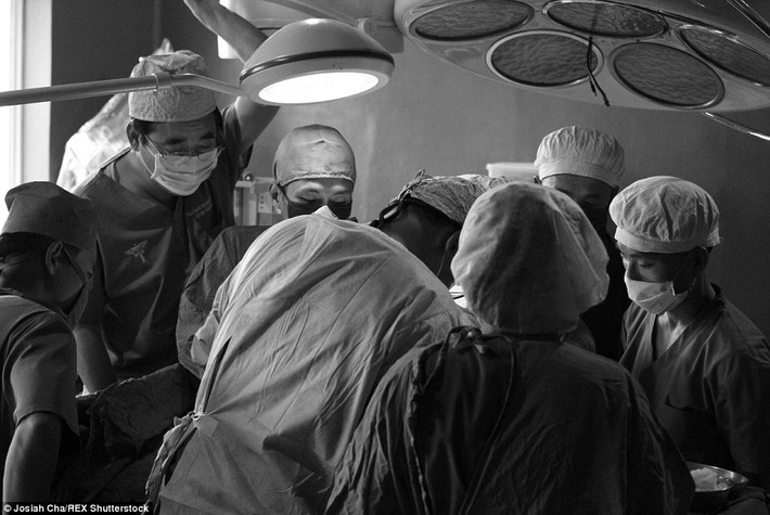 Một nhóm bác sĩ đang thực hiện ca phẫu thuật trong phòng mổ dưới điều kiện ánh sáng yếu và không ổn định.