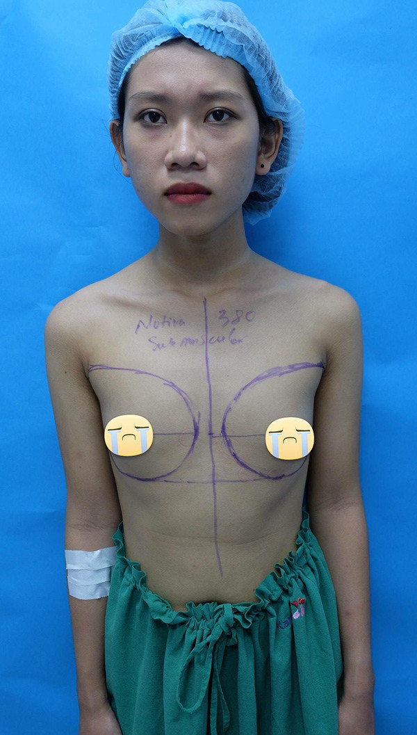 Kèm theo ảnh trước và sau phẫu thuật chuyển giới, Ngọc Anh cũng bày tỏ tâm sự rằng: "7 tháng trước, tôi là một thằng con trai và đây là tôi hiện tại - một đứa con gái bình thường. Nói chung tôi đập đi hết từ mặt, mũi, ngực… để thoát ra khỏi cái hình dạng không phải của mình trong hơn 20 năm qua, chịu nhiều sỉ nhục, đau đớn, và giờ tôi được là chính mình. Tôi nghĩ rằng cuộc đời là của mình, phải sống cho mình không phải cho một ai khác."