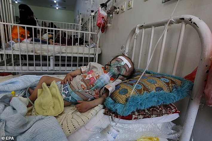 Một trẻ em Yemen khác đang phải thở oxy do bị suy dinh dưỡng nặng. Tại trung tâm này, trang thiết bị y tế thiếu thốn nghiêm trọng. Ảnh: EPA.