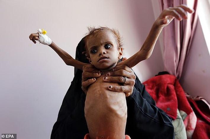 Cuộc xung đột ở Yemen đã tàn phá nhiều cơ sở hạ tầng tại quốc gia này và khiến ít nhất 10.000 người thiệt mạng. Ảnh:EPA.