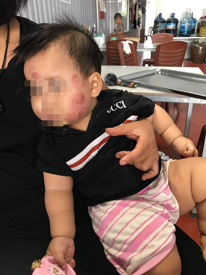 Bên cạnh việc tố cáo nhà trường bạo hành con mình, chị H. cũng cho biết nhà trường đã gửi lời xin lỗi về sự việc trên cùng với đó là đã có quà là 2 hộp sữa để bồi dưỡng cho cháu bé.