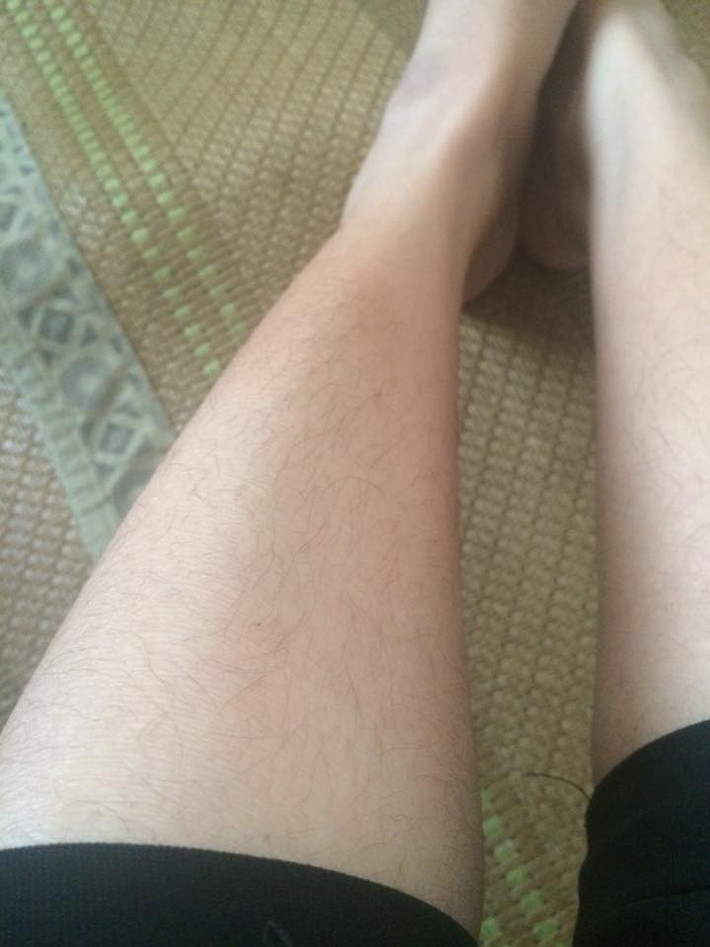 Chân trắng để làm gì khi mà lông chân của bạn cứ đen xì lại còn xoăn tít? Nhìn chân chán chẳng buồn nói gì nữa