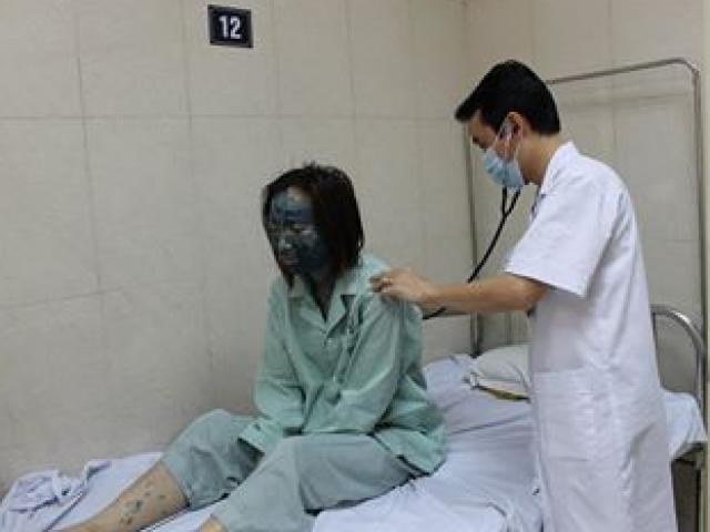 Bên cạnh đó, các thành viên khác cũng chia sẻ những hình ảnh mình bị thủy đậu mà cả người bị bôi thuốc xanh methylen chẳng khác gì người ngoài hành tinh.