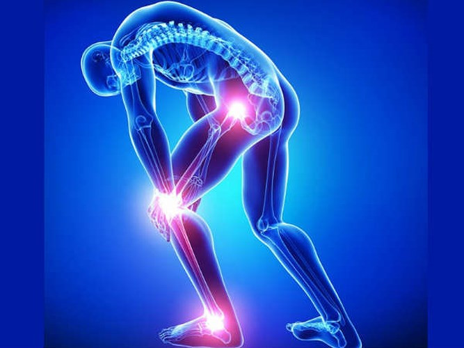 Viêm xương khớp là một bệnh thoái hóa khớp xảy ra khi có sự hao mòn của các mô sụn nối các khớp của cơ thể. Sụn bị yếu đi và bị tổn thương, gây viêm xương khớp. Một số triệu chứng thường gặp của viêm xương khớp là đau ở các khớp cổ, tay, ngón tay, hông, khuỷu tay, đầu gối, lưng dưới,...