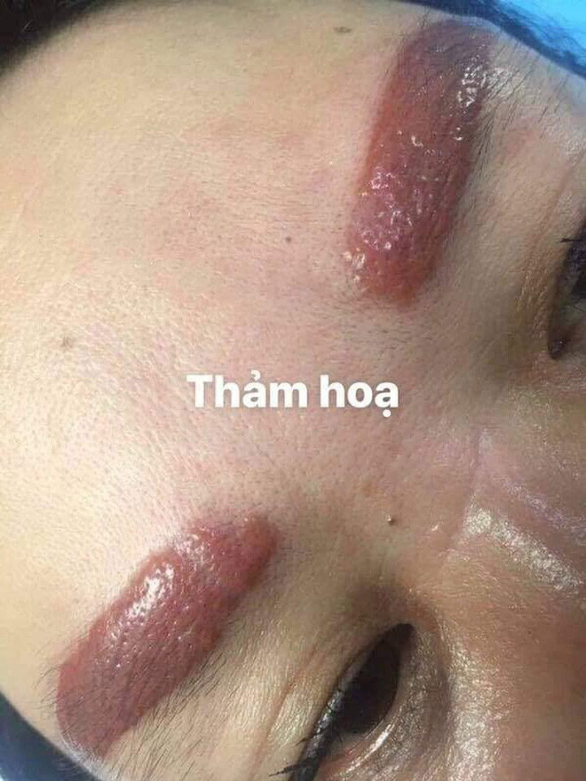 Mới đây, trong một nhóm kín trên mạng xã hội, dân mạng đã không khỏi xôn xao về những hình ảnh phun xăm thẩm mỹ phiên bản lỗi.
