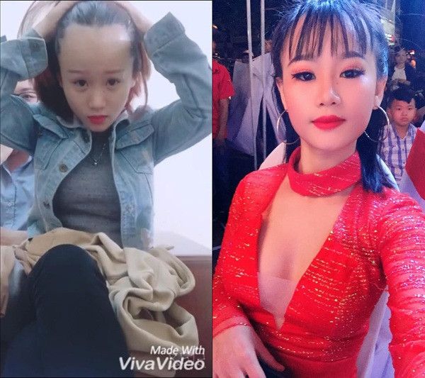 Đối với bất kỳ cô nàng nào cũng vậy, ai mà chẳng mong muốn mình sở hữu ngoại hình ưa nhìn, thu hút. Bởi vậy mà chỉ cần có một chút "lỗi" nào trên diện mạo thôi thì dù là nhỏ nhất cũng khiến hội chị em mất tự tin.