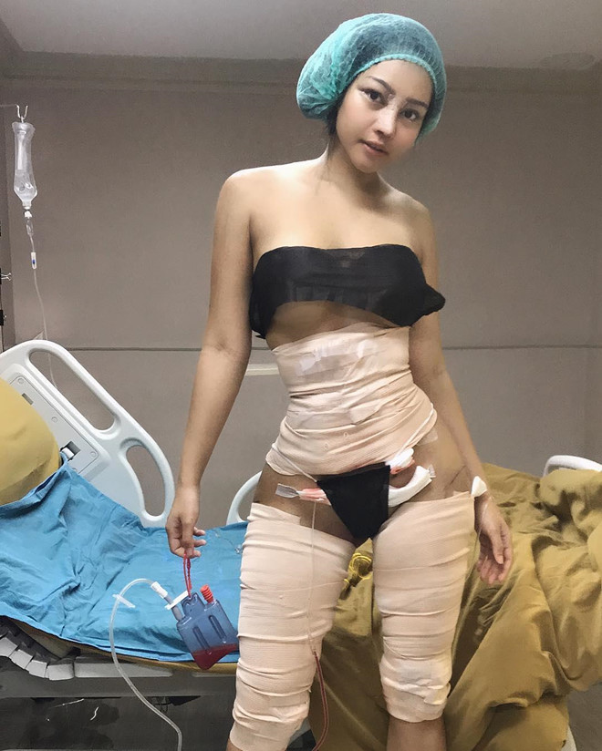 Mới đây, hot girl Thái Lan này công khai hình ảnh phẫu thuật thẩm mỹ vòng eo trên trang cá nhân khiến CĐM được phen xôn xao. Đây không phải lần đầu tiên Nayika khiến nhiều người bất ngờ bởi những thay đổi từ ngoại hình của mình.